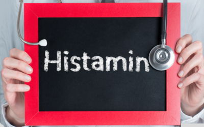 Intolerancia a la Histamina: ¿Qué alimentos comer?